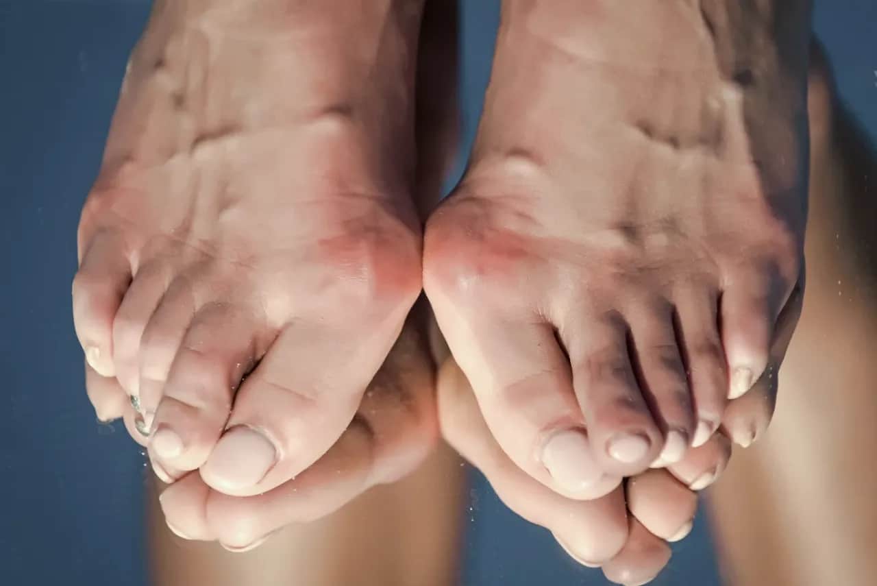 Jak złagodzić ból haluksa? Skuteczne metody i domowe sposoby