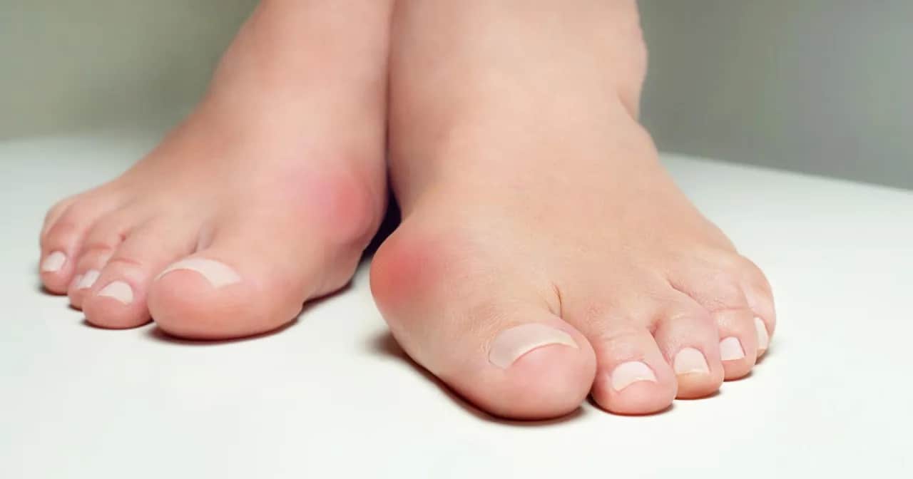 Jaki lekarz leczy haluksy? Poznaj ortopedę i skuteczne metody